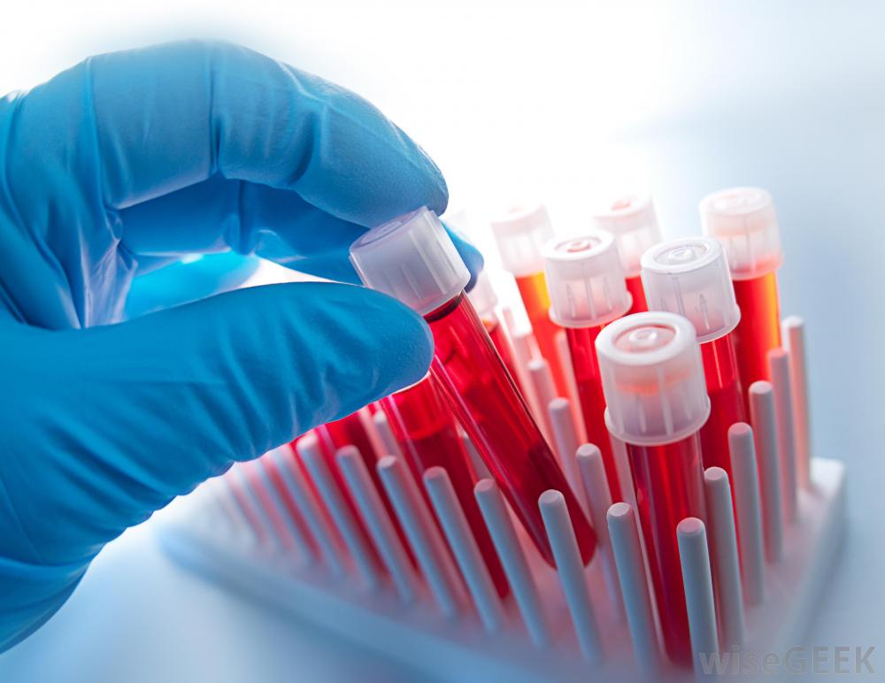 Blood-Test-Tube Image